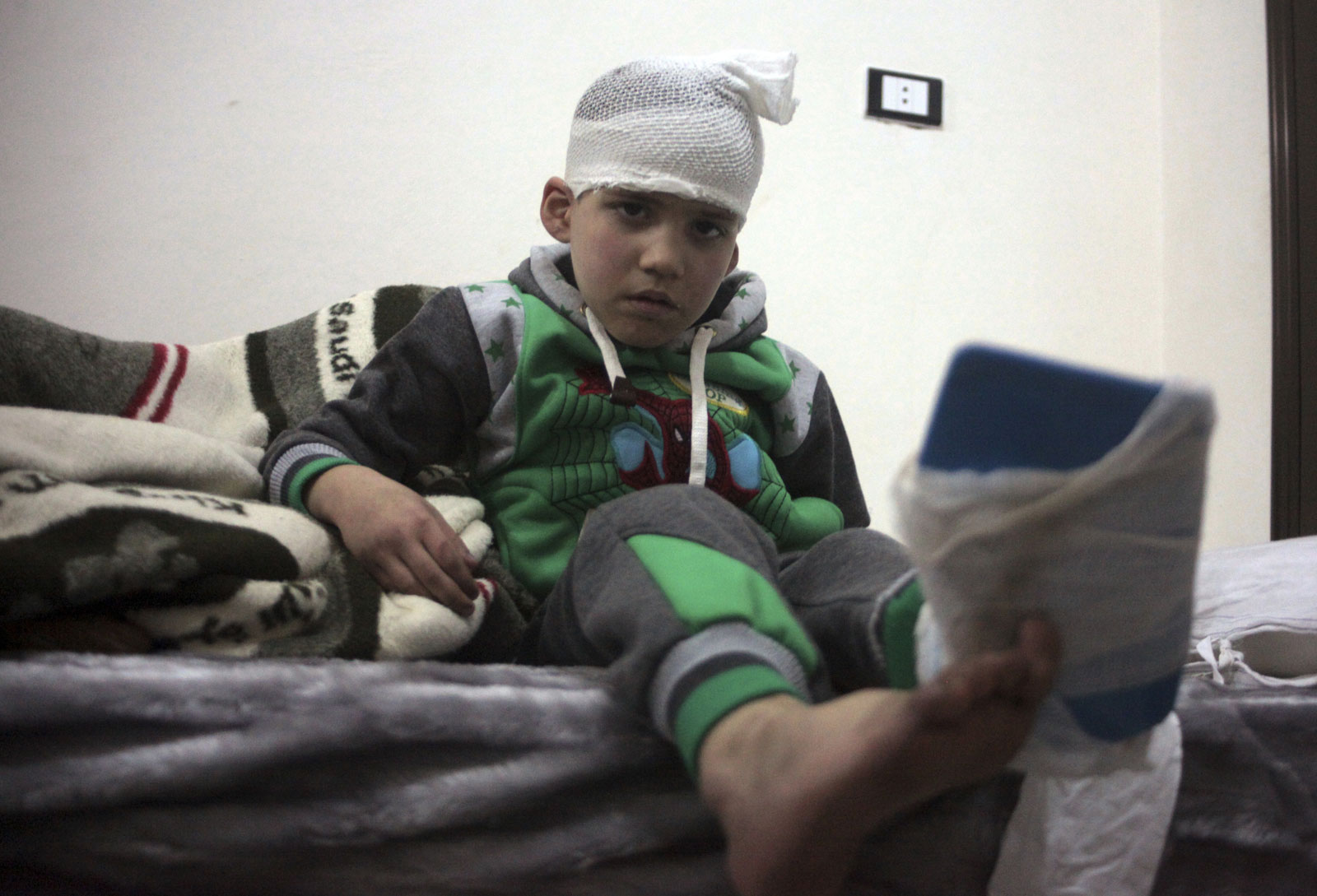 Un niño herido evacuado de Aleppo, Siria. (AP)