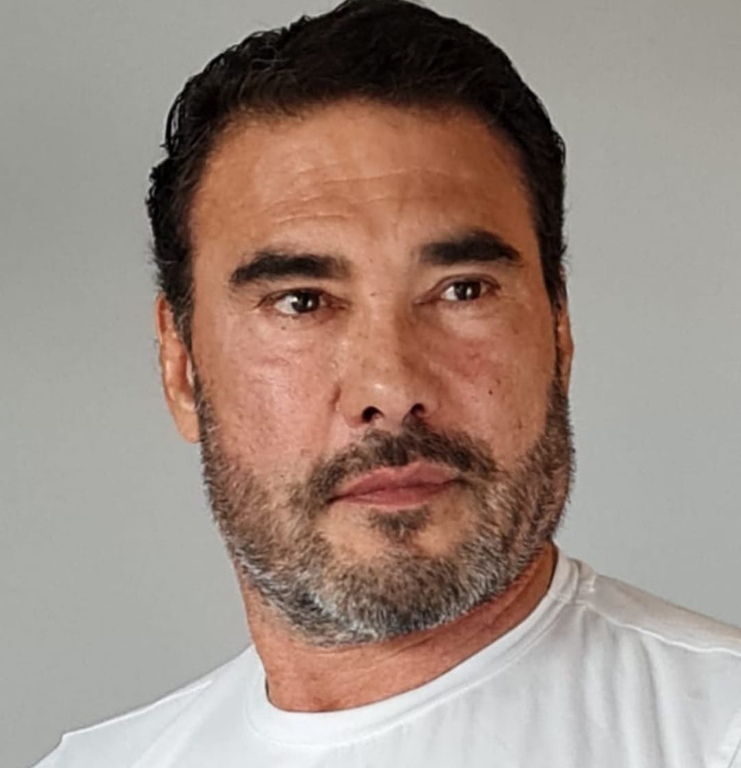 Eduardo Yañez Antes Y Despues 24 Barrio